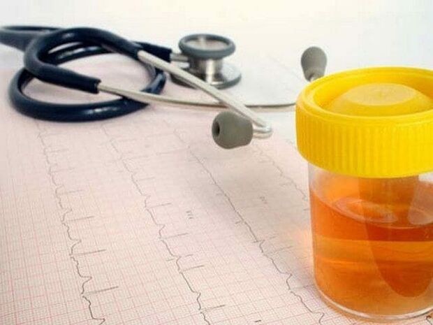 šlapimo analizė cistitui diagnozuoti